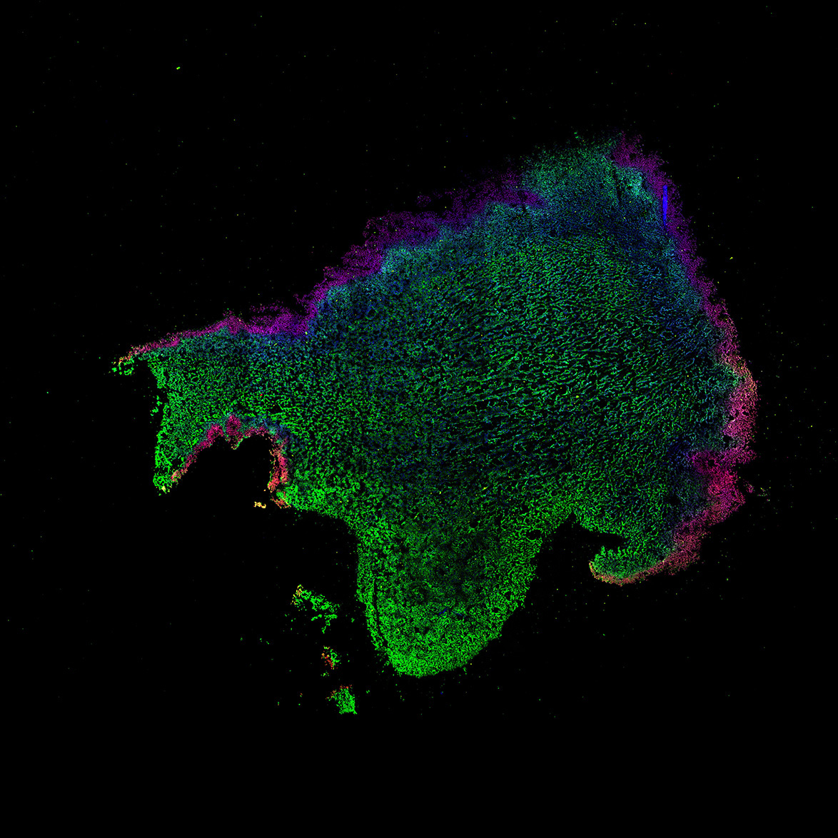 Human foetal midbrain